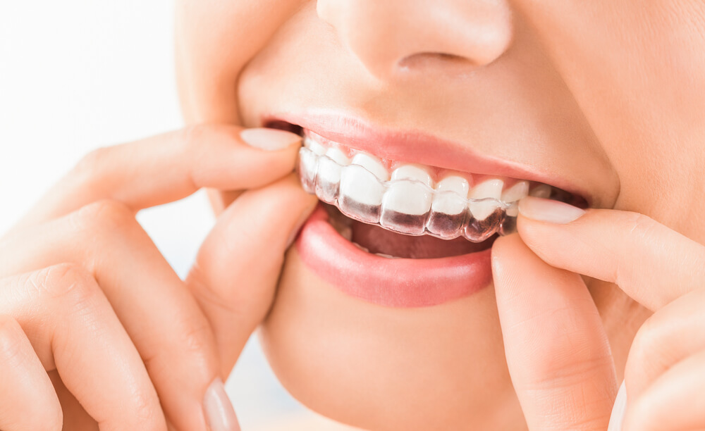 The Importance of Dental Health: A Comprehensive Guide to Achieving a Bright Smile